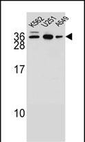 Rabbit Polyclonal Antibody to AMN1 (N-term)