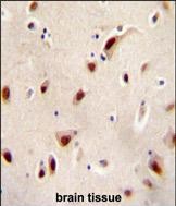 Rabbit Polyclonal Antibody to IQCJ