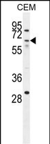 ZNF674 (N-term)