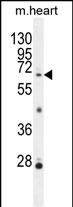 Rabbit Polyclonal Antibody to NKPD1
