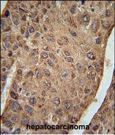 Rabbit Polyclonal Antibody to RPL27A