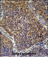 Rabbit Polyclonal Antibody to CD2BP2 (N-term)