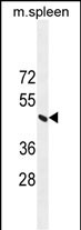 ERCC8