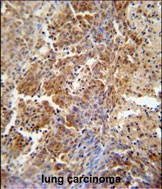 Rabbit Polyclonal Antibody to ERCC8