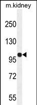 Rabbit Polyclonal Antibody to KIAA1324L (N-term)