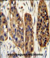 Rabbit Polyclonal Antibody to KIAA1324L (N-term)