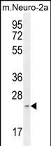 RT34 (N-term)