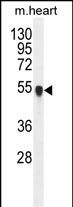 PPM1L  (C-term)