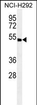 ABHD8  (C-term)