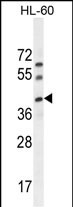 C17orf59
