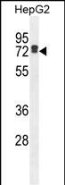 LRC40  (C-term)