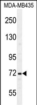 SRBD1  (C-term)