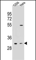 OR5L2 (N-term)