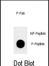Phospho-JMJD1B(S291)