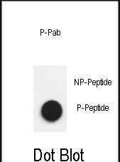 Phospho-Nephrin(Y1193))