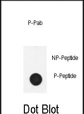 Phospho-Nephrin(Y1210))