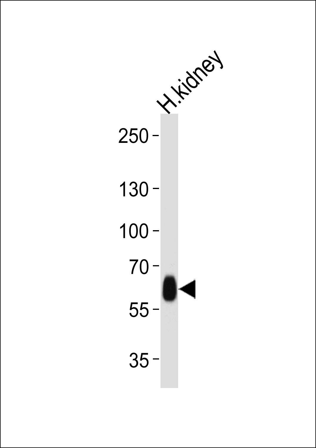 DFNB31