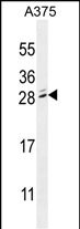 MBD3L2