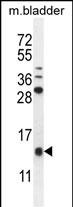KTAP2  (C-term)