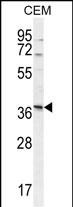 NXPH4