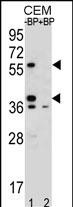 MNDA (N-term)