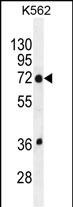 TMEM151B (N-term)