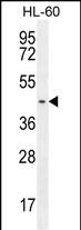 GPR142 (N-term)