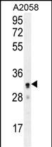 UBXN2A