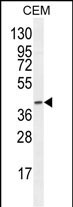 F8A2 (N-term)