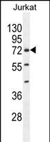 ZNF648 (N-term)