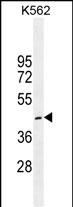 CRFR1 (Q103)