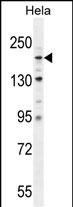 COL4A2 (N-term)