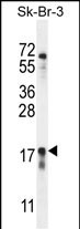 CA115
