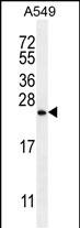 SNX24 (N-term)