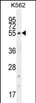 CCDC61 (N-term)