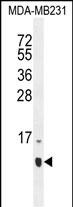 HCFC1R1 (N-term)