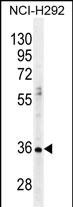 PRSS21