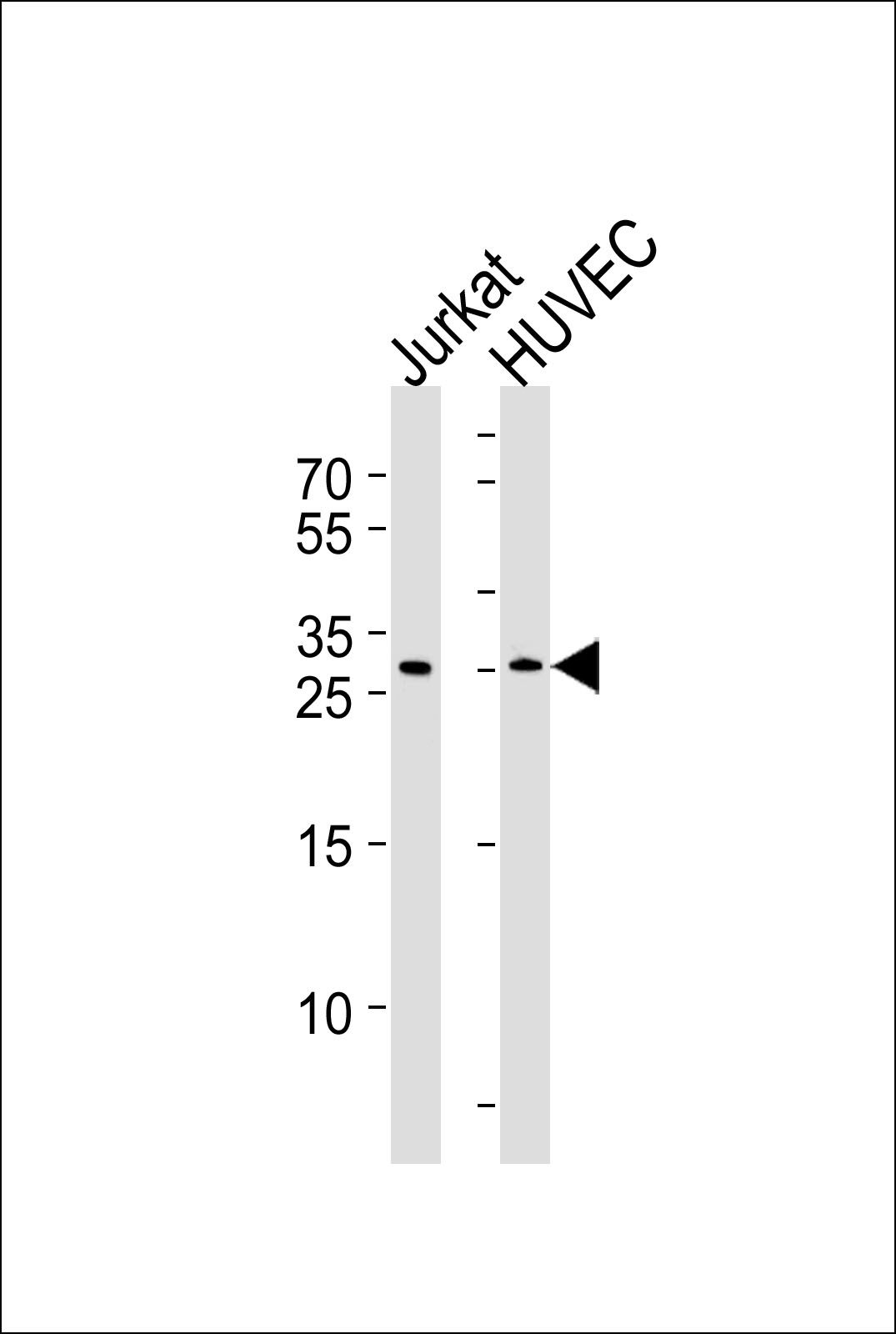 DKK4