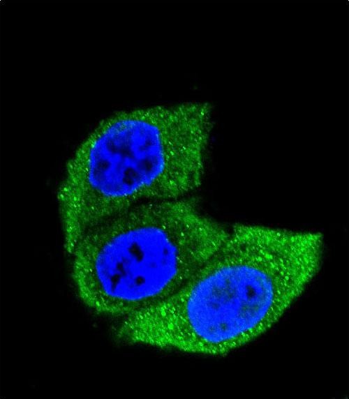 Mouse Monoclonal Antibody to HSPA1A