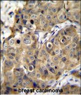 Rabbit Polyclonal Antibody to TMEM100