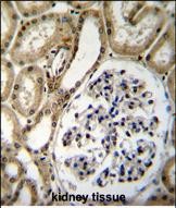 Rabbit Polyclonal Antibody to BRUNOL6 (N-term)