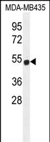 ZNF286B (N-term)