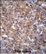 Rabbit Polyclonal Antibody to PLEKHA4 (N-term)