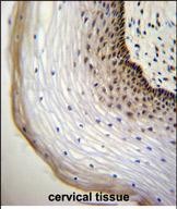 Rabbit Polyclonal Antibody to NUP107