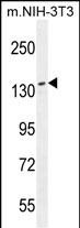 NUP160
