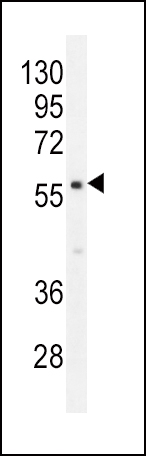 PDE1B