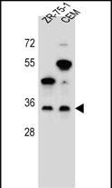 GPM6B (N-term)