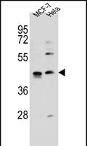 ZNF384