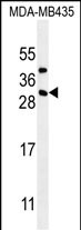 CD8B1