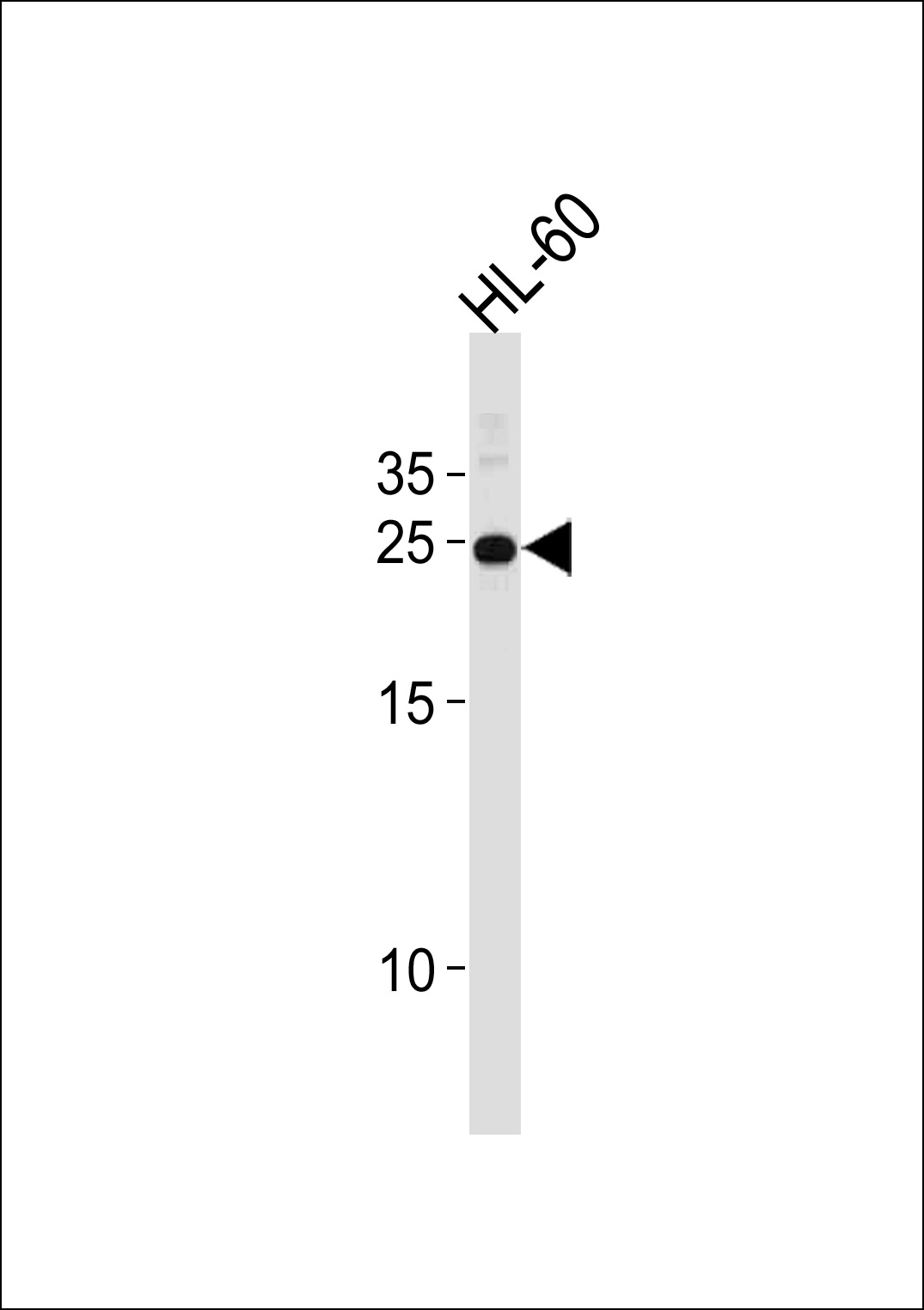 HOXA6
